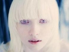 世界上稀有的银眼睛人多数竟是白化病人，艾薇儿银眼睛似精灵
